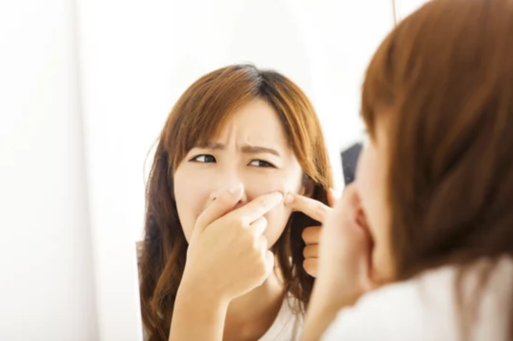  턱, 이마, 코에 아픈 여드름 원인과 대처법