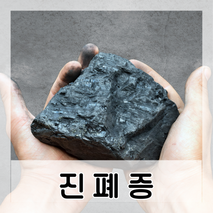  진폐증 종류 규폐증 석면폐증 용접공폐증 면폐증