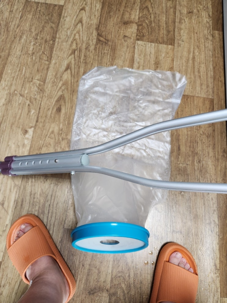 핀 제거 수술 후 4일차 샤워하고 셀프소독 [수술부위 사진 있음]