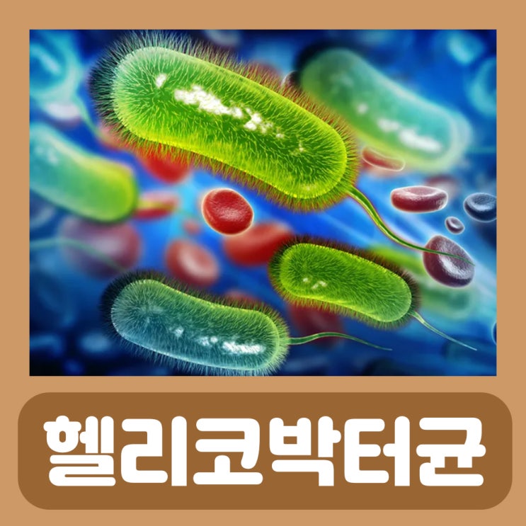  헬리코박터 제균치료 술 헬리코박터균 치료 원인 증상 약 전염 검사