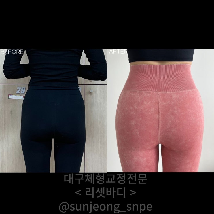  [대구SNPE 리셋바디] 허리골반라인 고민이신분 필독 !! 이거만 안 해도 100% 개선 될 수 있어요!!