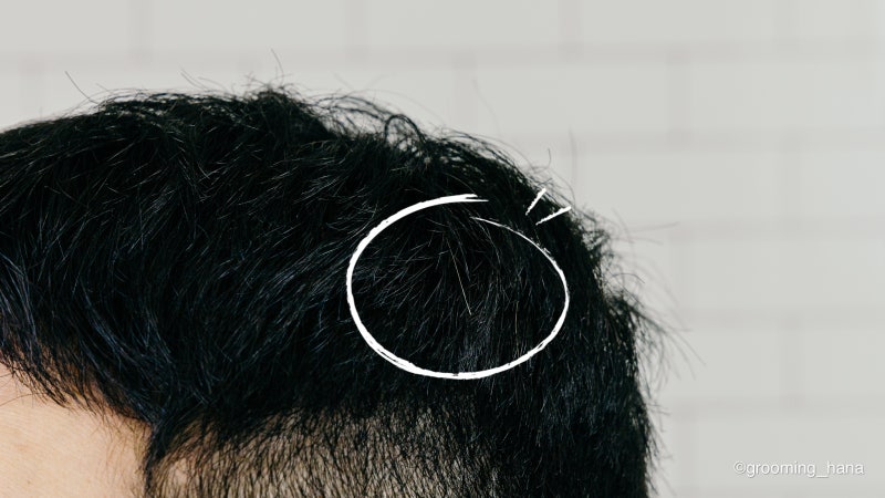 남자 짧은머리, 순한 새치커버 염색약 추천 (Ft. 흰머리 셀프염색 잘하는법) : 네이버 블로그