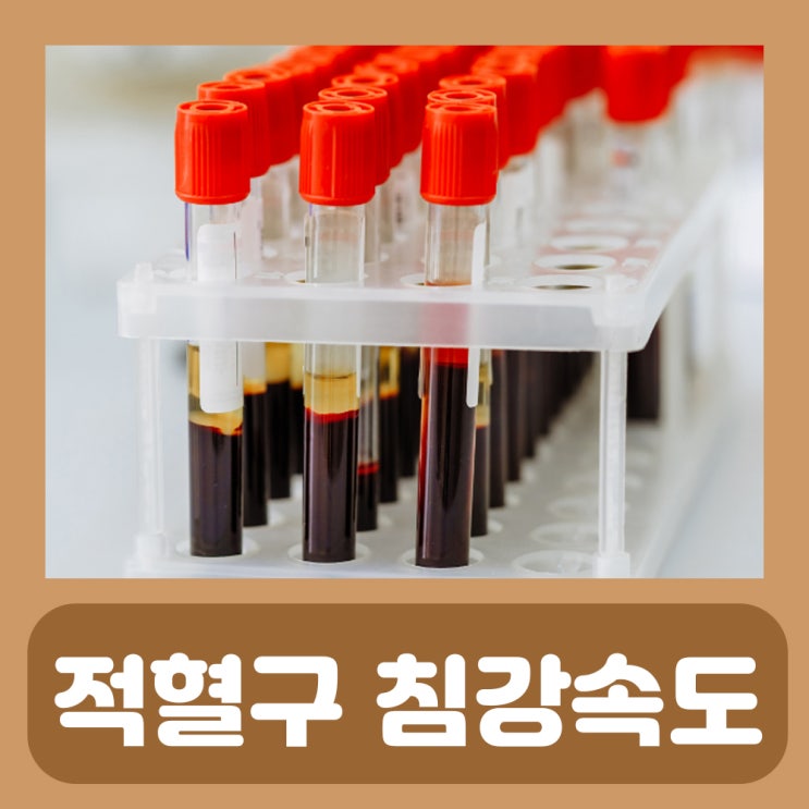  ESR 검사 수치 적혈구 침강속도 쉽게 알아보자