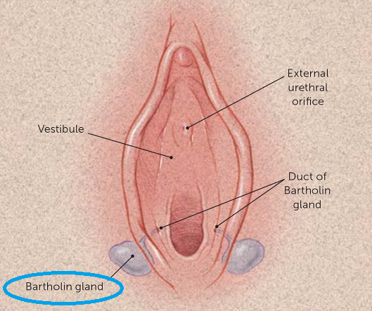 바르톨린 낭종 (Bartholin's cyst)