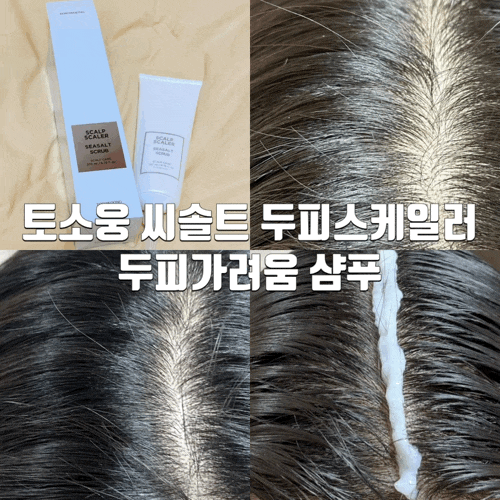  토소웅 씨솔트 두피스케일러 두피가려움 샴푸로 머리가려움,두피 뾰루지 탈출