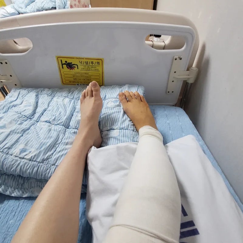 대구 광개토병원 화상치료, 수술 총후기. (비용,치료기간,진료시간,주차장,꿀팁 등등)