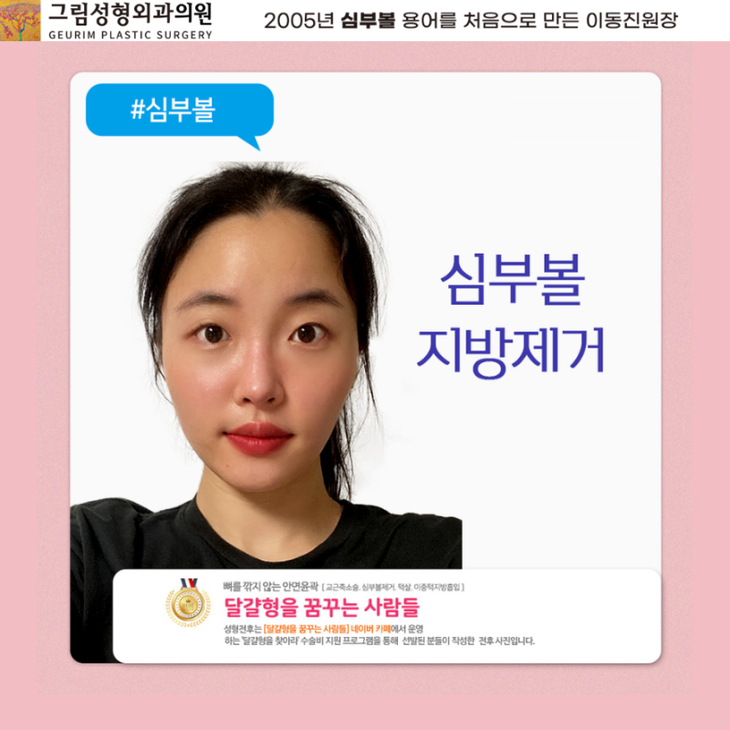 Comparison of differences in deep ball fat removal procedures