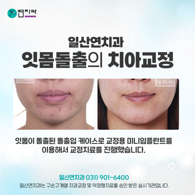 일산치과의원 과정에 대해 자세히 알아보세요.