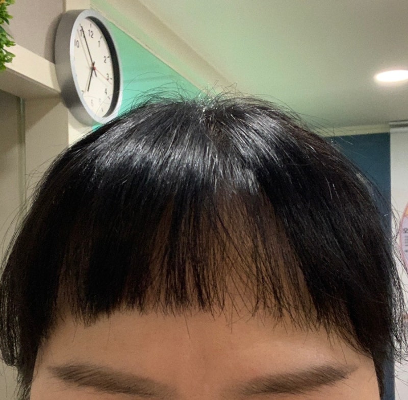 미녹시딜정 미녹스5 록시딜 해외직구에 대한 관세사무실 답변 : 네이버 블로그