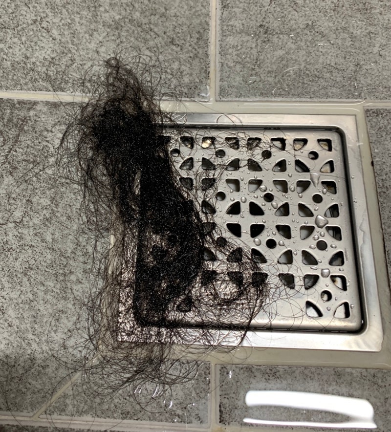 미녹시딜정 미녹스5 록시딜 해외직구에 대한 관세사무실 답변 : 네이버 블로그