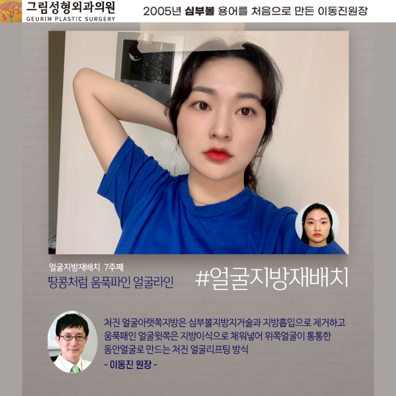 얼굴 지방 재배치, 중년에 더 처질 수 있습니까? (Feat. 화독제거 소독제거) 6