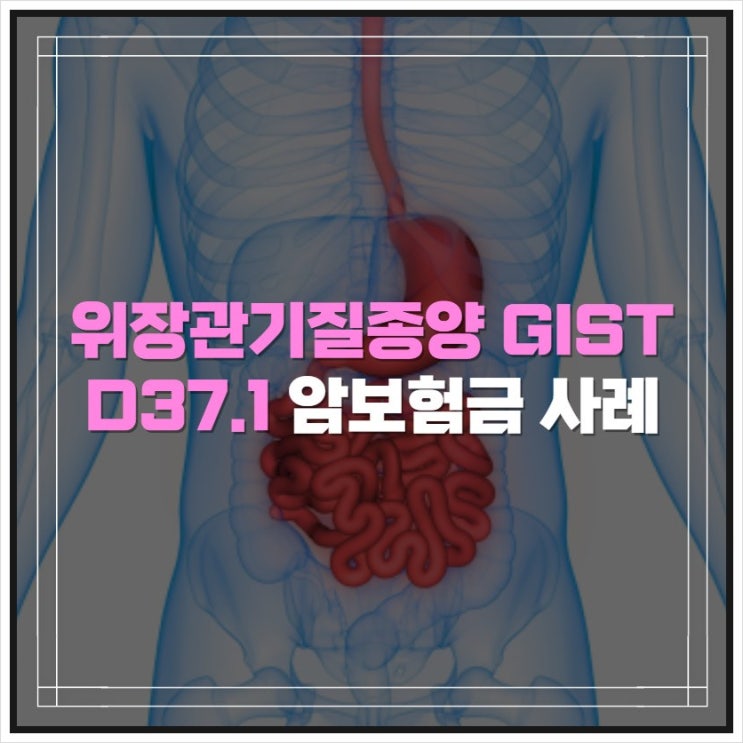 위장관기질종양 D37.1 암보험금 손해사정 사례
