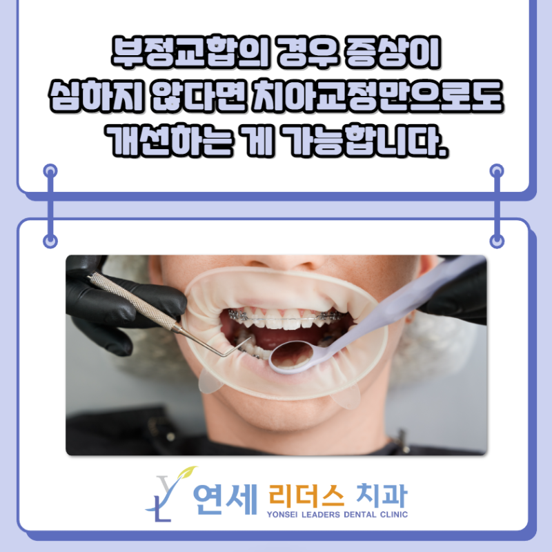 어린이 부정교합의 종류에는 어떤 것들이 있나요? 6