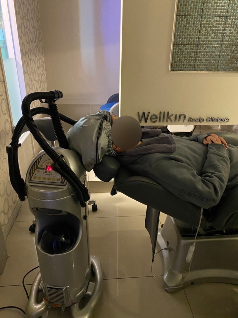 울산탈모클리닉 두피가 비어보이는게 느껴지기 시작하면 5