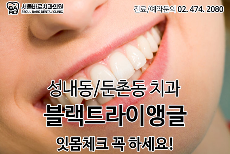  블랙 트라이앵글? 이 말을 들었다면, 둔촌동 치과에서 잇몸 체크 꼭 하세요.