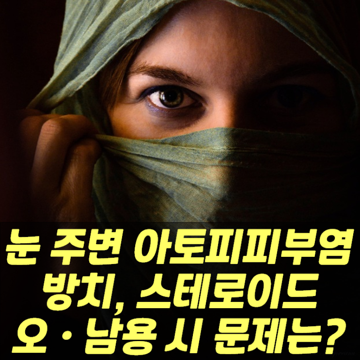  눈 주변 아토피 피부염...방치,스테로이드 오·남용 시 발생하는 문제는?