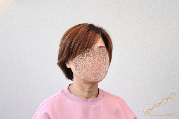 대구 항암가발 후회없는 선택을 하고 싶다면 'click' [대구 위풍당당] 2