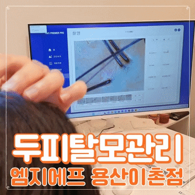  더마힐샴푸 엠지에프 용산탈모관리 엄마가 만족하세요