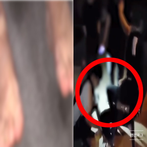  생일빵 기름 뿌리고 폭죽 터뜨려 화상입힌 친구들 현실판 더글로리 영상