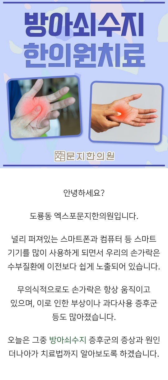 분당 방아쇠수지, 방아쇠손가락 한의원 봉침치료, 재생고 처방