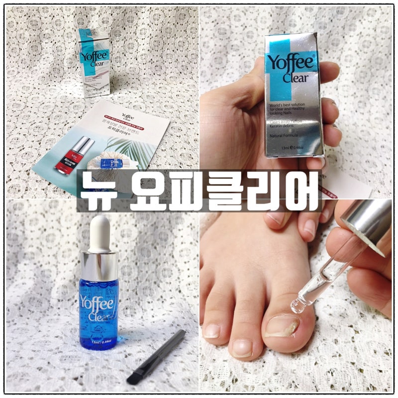 손톱 발톱 무좀약: 요피클리어 1