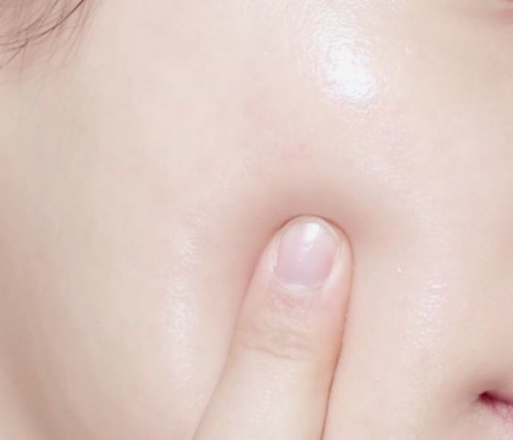  환절기 건강한 피부 관리 방법