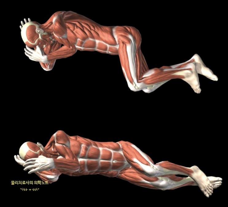 잘못된 수면자세(잠자는 자세) - 옆으로 누운자세(Side-lying position)는 "라운드숄더", "어깨충돌증후군", "다리길이차이", "골반전방경사"를 유발한다?!