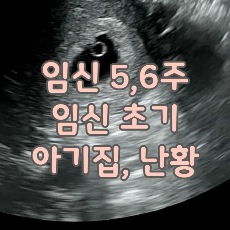 임신 기록 5,6 주차 임신 초기 증상 아기집 난황 임신사실확인서