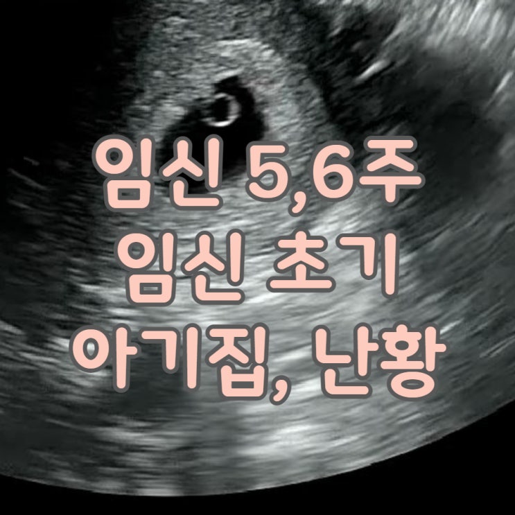  임신 기록 5,6 주차 임신 초기 증상 아기집 난황 임신사실확인서
