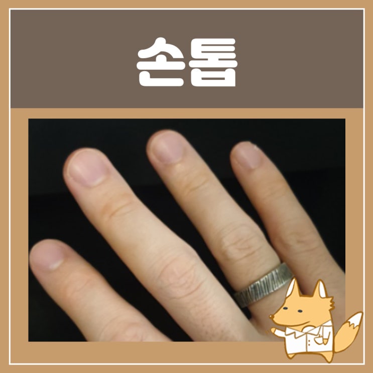  손톱 검은세로줄 손톱검은색 : 손톱 검은점 검은선 엄지손톱 검은줄