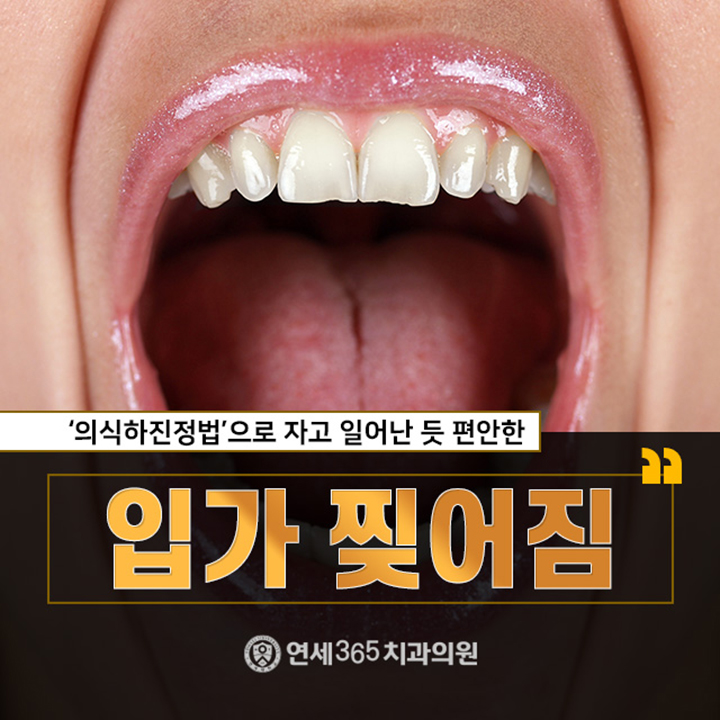  입가 찢어짐 겨울철에 더 조심해요