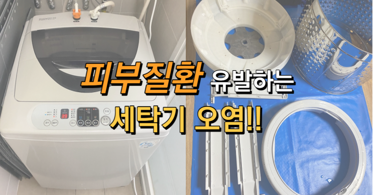  빨래 후에 몸이 가려워요!!