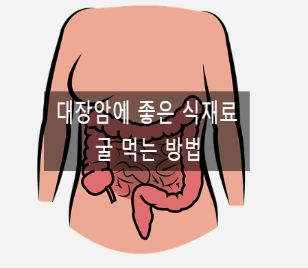  대장암에 좋은 식재료는 어떤 것이 있을까