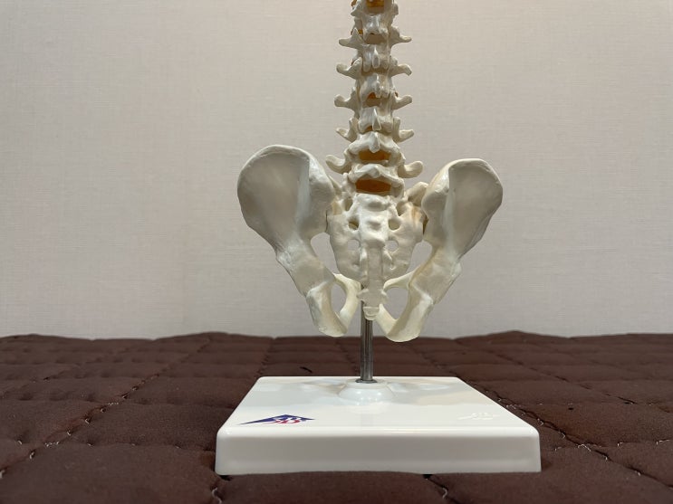  엉덩이 엉치 고관절 골반 통증은 천장관절 문제로 발생합니다