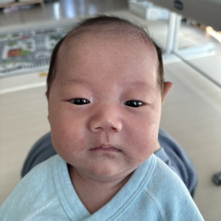  신생아태열 비판텐 괜찮을까? 태열 없애는 방법 크림추천 찐후기