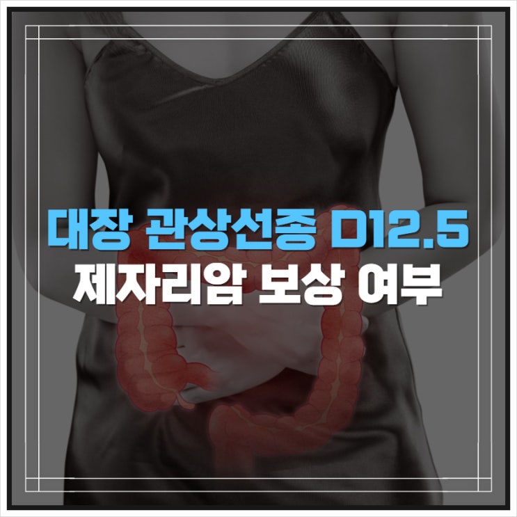 대장 관상선종 (tubular adenoma) D12.5 제자리암진단비 받을 수 있나