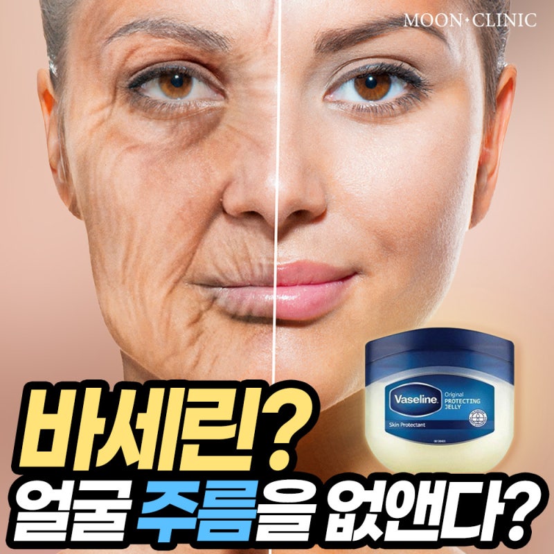 바세린 얼굴 주름을 없앤다? : 네이버 블로그 바세린 얼굴 주름을 없앤다? : 네이버 블로그