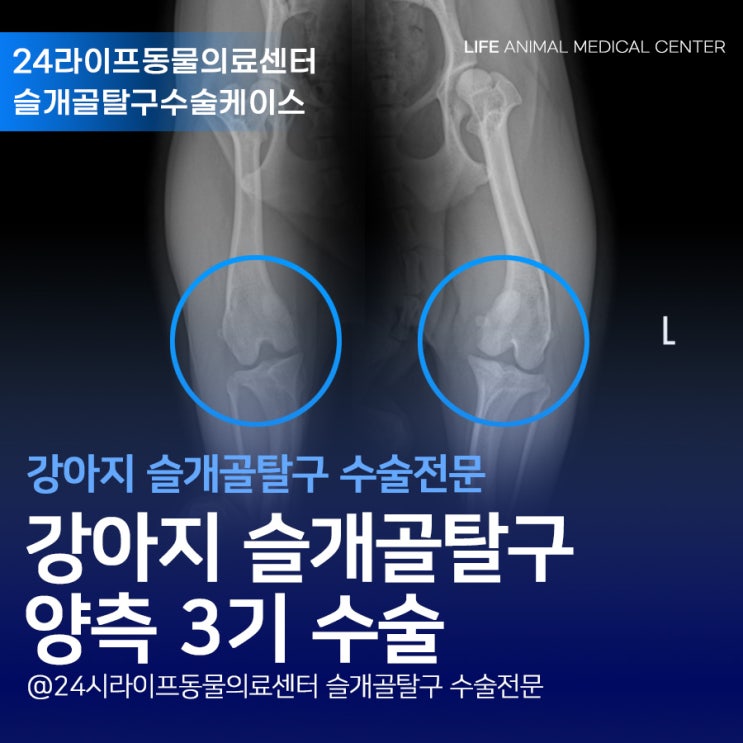 대구 강아지슬개골탈구수술 전문 : 강아지 다리에 힘이 자꾸 빠져요 6살 시츄 슬개골탈구 3기수술 대구 강아지슬개골탈구수술 전문 : 강아지 다리에 힘이 자꾸 빠져요 6살 시츄 슬개골탈구 3기수술