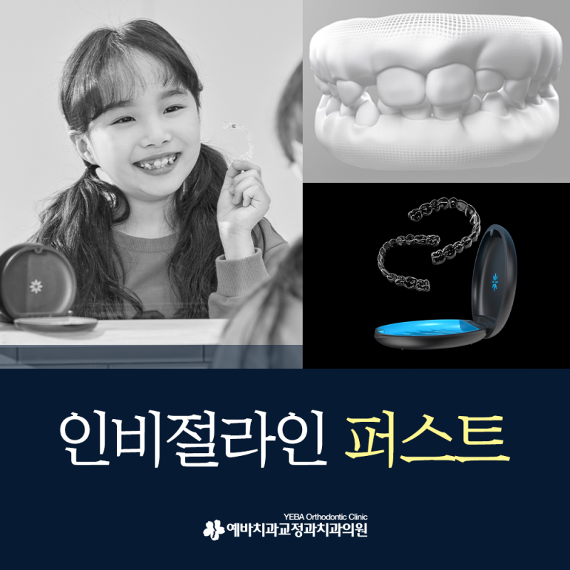 부산 어린이 치아 교정 투명 교정으로 치료하는 방법은?