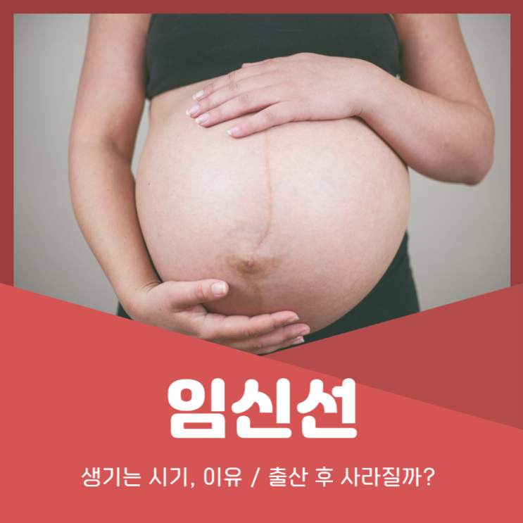 임신초기 임신선 생기는 이유, 출산 후 사라질까?