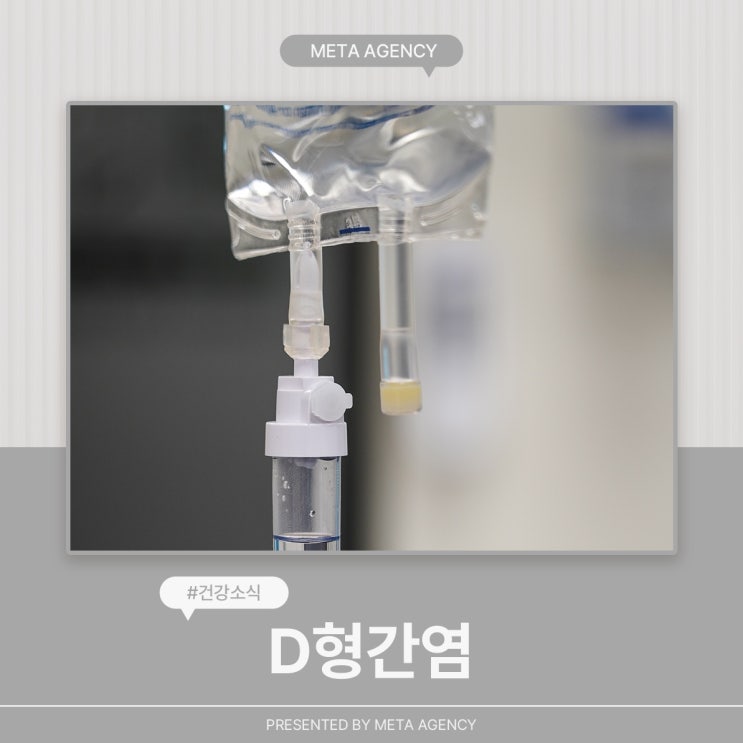  D형간염 초기증상, 특이증상, 예방법