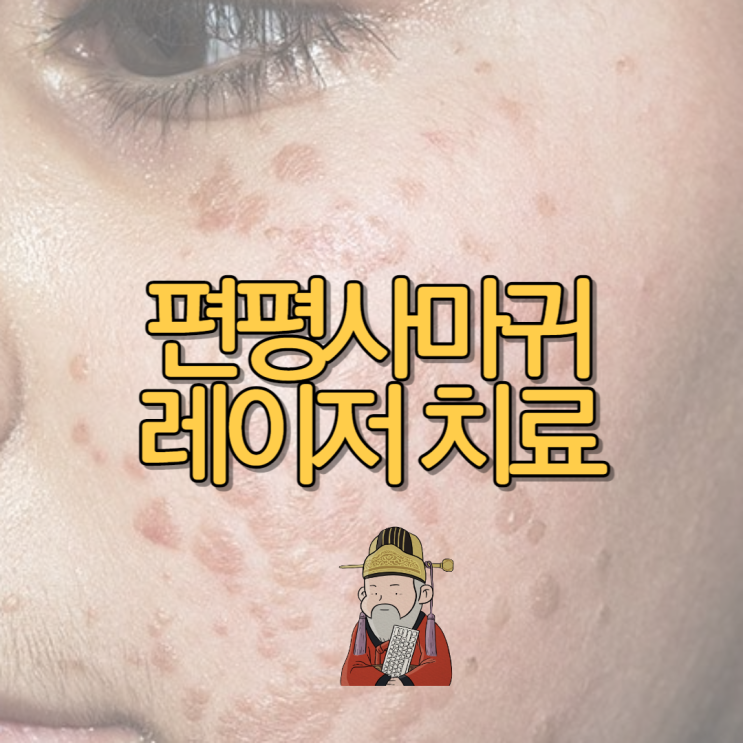  편평사마귀 레이저 치료 가격 후기