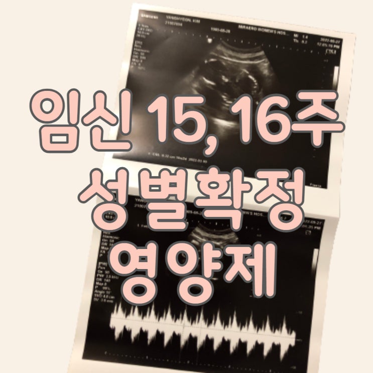  임신 기록 15주,16주  영양제 총총이 성별 확정 반전은?