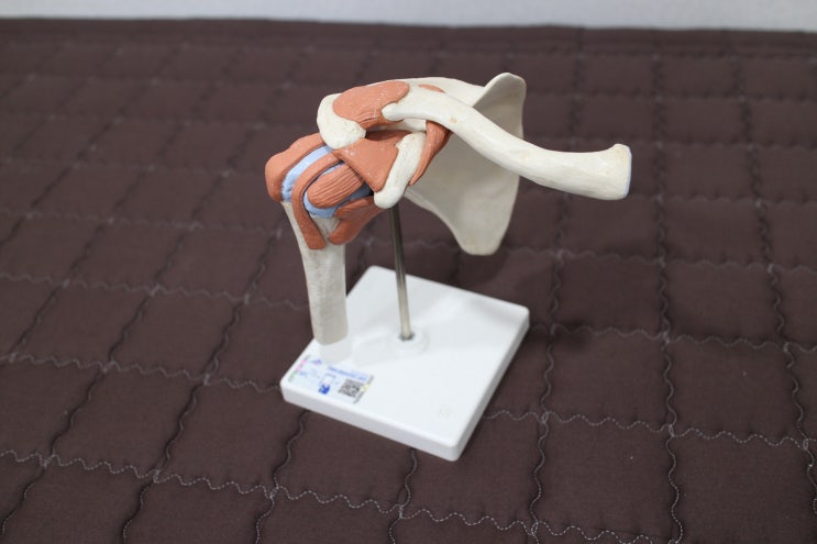  방카르트 병변 원인, 증상, 한의원 치료, 생활관리 방법
