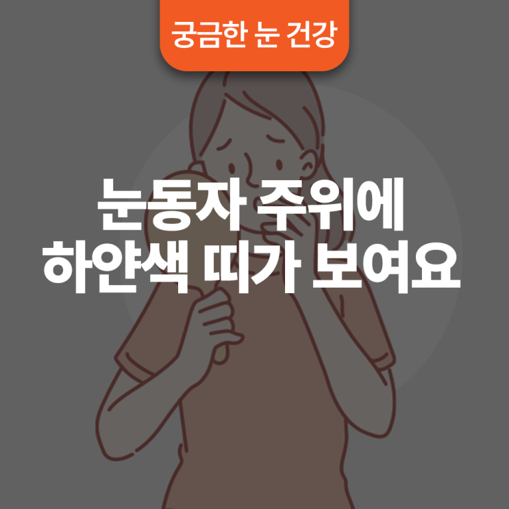  눈동자 주위에 하얀색 띠가 보여요