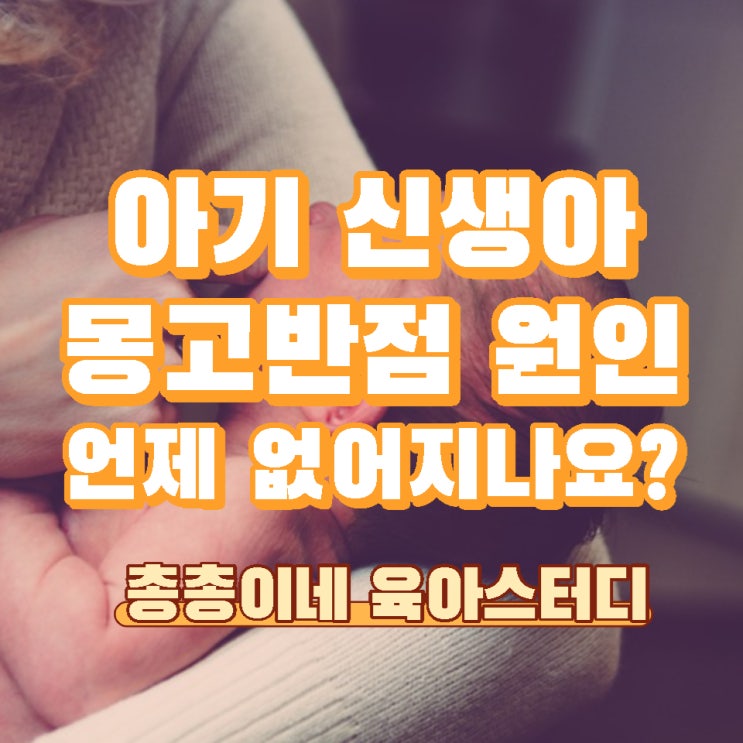  몽고반점 언제 없어지나요? 원인 없어지는 시기 아기 이소성 반점