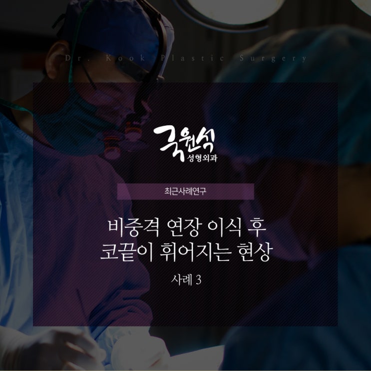  비중격연장이식 후 코가 휘어진 실제 사례!