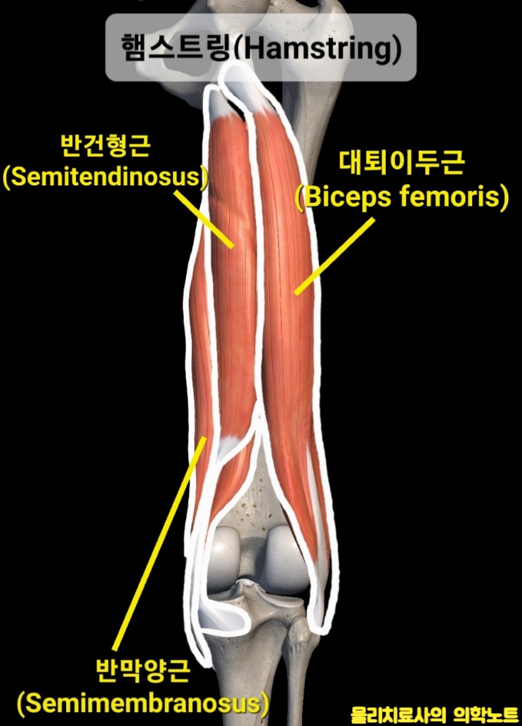 고관절 통증 원인 : 햄스트링(Hamstring), 대퇴이두근 단축(Shortness of Biceps femoris) + 무릎 안쪽 통증(외반슬, Genu valgum)
