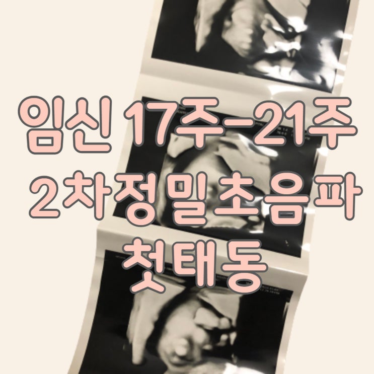  임신 기록  17주- 21주차  2차 정밀초음파 첫태동 증상