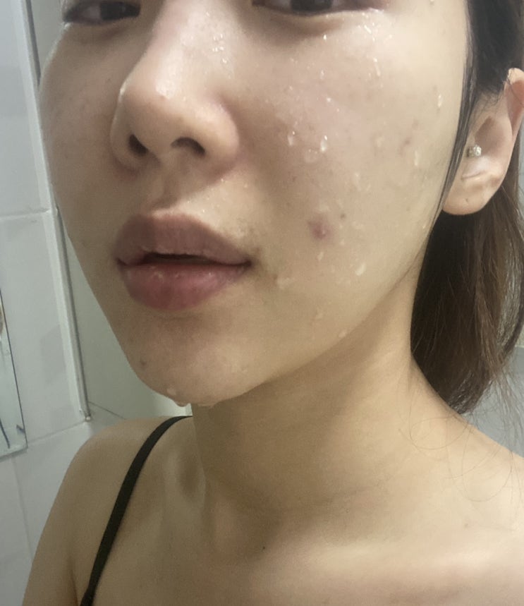  여드름 폼클렌징 에이솔루션 트러블 케어로 딱이야